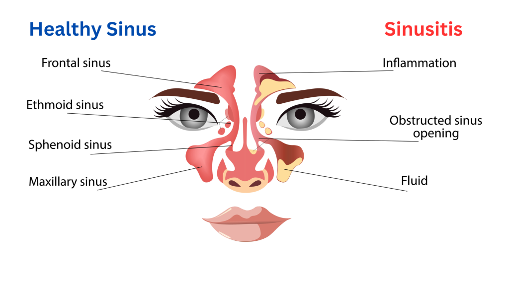 medical marijuana card fremont