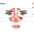 medical marijuana card fremont